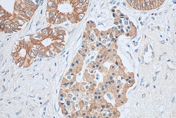 GALR2 Rabbit Polyclonal Antibody, Proteintech:Antibodies:Primary Antibodies