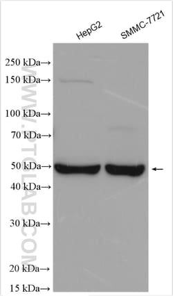 GALR2 Rabbit Polyclonal Antibody, Proteintech:Antibodies:Primary Antibodies
