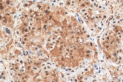 GAPDH (Human Specific) Rabbit Recombinant Antibody, Proteintech:Antibodies:Primary