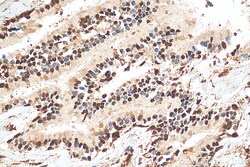 GAPDH (Human Specific) Rabbit Recombinant Antibody, Proteintech:Antibodies:Primary