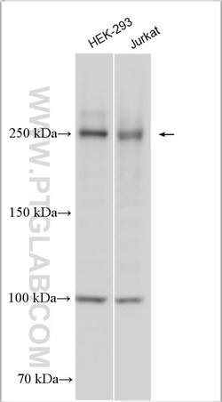 GARNL1 Rabbit Polyclonal Antibody, Proteintech Unconjugated; 150 &mu;L:Antibodies,