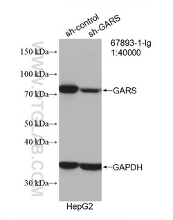 GARS Mouse Monoclonal Antibody, Proteintech Unconjugated; 20 &mu;L:Antibodies,