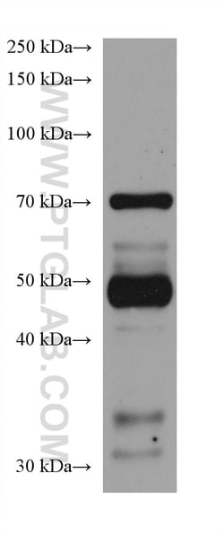 GAS2L1 Mouse Monoclonal Antibody, Proteintech:Antibodies:Primary Antibodies