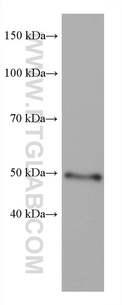 GATA2 Mouse Monoclonal Antibody, Proteintech:Antibodies:Primary Antibodies