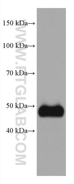 GATA2 Mouse Monoclonal Antibody, Proteintech:Antibodies:Primary Antibodies