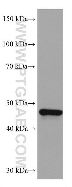 GATA4 Mouse Monoclonal Antibody, Proteintech Unconjugated; 150 &mu;L:Antibodies,