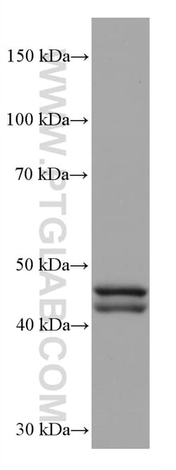 GATA4 Mouse Monoclonal Antibody, Proteintech Unconjugated; 150 &mu;L:Antibodies,