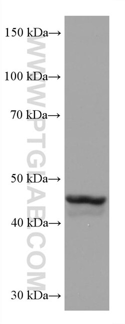 GATA4 Mouse Monoclonal Antibody, Proteintech Unconjugated; 150 &mu;L:Antibodies,