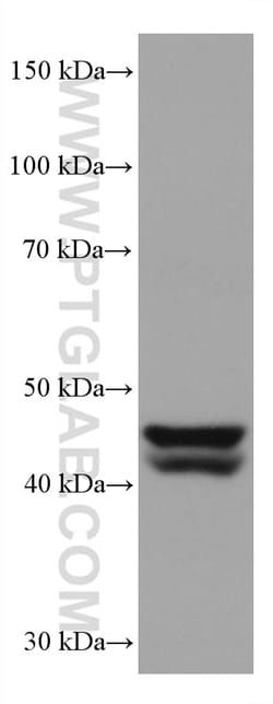 GATA4 Mouse Monoclonal Antibody, Proteintech Unconjugated; 150 &mu;L:Antibodies,