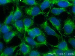GATC Mouse Monoclonal Antibody, Proteintech:Antibodies:Primary Antibodies