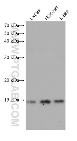 GATC Mouse Monoclonal Antibody, Proteintech:Antibodies:Primary Antibodies