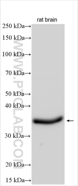 GATSL2 Rabbit Polyclonal Antibody, Proteintech Unconjugated; 150 &mu;L:Antibodies,