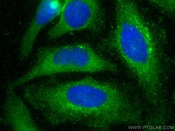 GLO1 Mouse Monoclonal Antibody, Proteintech:Antibodies:Primary Antibodies
