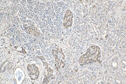 GLUT2 Mouse Monoclonal Antibody, Proteintech Unconjugated; 150 &mu;L:Antibodies,