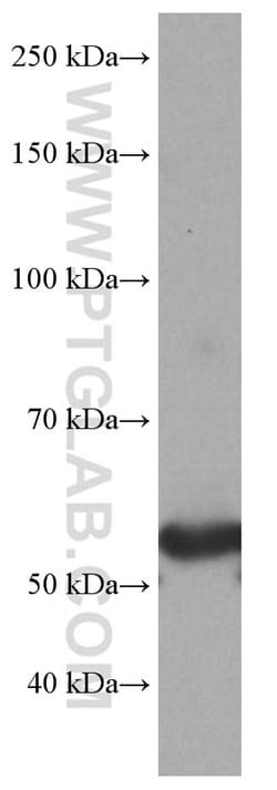 GLUT2 Mouse Monoclonal Antibody, Proteintech Unconjugated; 150 &mu;L:Antibodies,