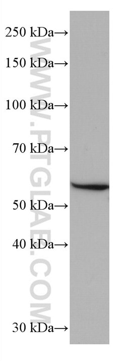 GLUT2 Mouse Monoclonal Antibody, Proteintech Unconjugated; 150 &mu;L:Antibodies,