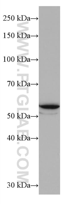 GLUT2 Mouse Monoclonal Antibody, Proteintech Unconjugated; 150 &mu;L:Antibodies,