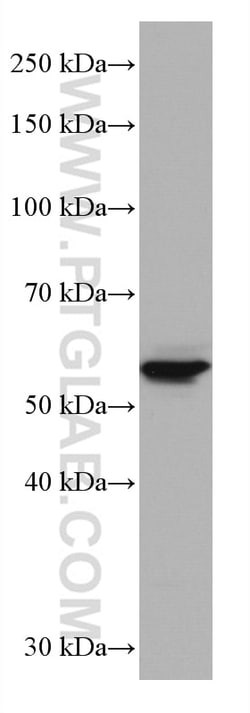 GLUT2 Mouse Monoclonal Antibody, Proteintech Unconjugated; 150 &mu;L:Antibodies,