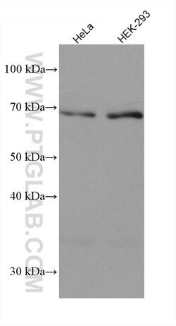 GMEB2 Mouse Monoclonal Antibody, Proteintech:Antibodies:Primary Antibodies