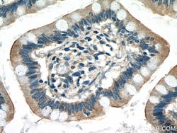 GNA15 Rabbit Polyclonal Antibody, Proteintech:Antistoffer:Primære antistoffer