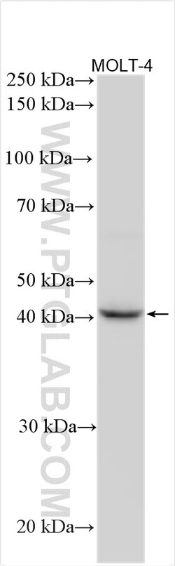 GNA15 Rabbit Polyclonal Antibody, Proteintech:Antistoffer:Primære antistoffer