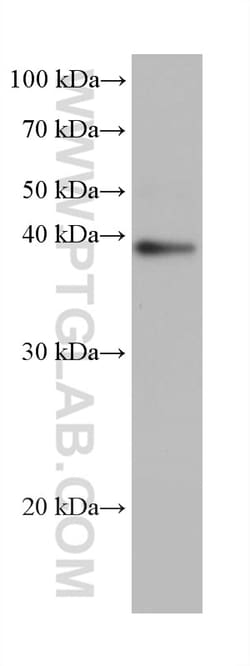 GNAI1 Mouse Monoclonal Antibody, Proteintech Unconjugated; 20 &mu;L:Antibodies,