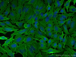 GNAI3 Mouse Monoclonal Antibody, Proteintech:Antibodies:Primary Antibodies