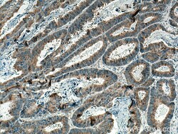 GOLPH3 Mouse Monoclonal Antibody, Proteintech:Antibodies:Primary Antibodies