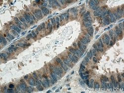 GOLPH3 Mouse Monoclonal Antibody, Proteintech:Antibodies:Primary Antibodies