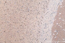 GOT2 Mouse Monoclonal Antibody, Proteintech:Anticorps:Anticorps primaires