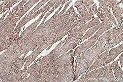 GOT2 Mouse Monoclonal Antibody, Proteintech:Anticorps:Anticorps primaires