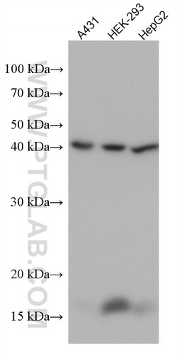 GOT2 Mouse Monoclonal Antibody, Proteintech:Anticorps:Anticorps primaires