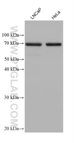 GPD2 Mouse Monoclonal Antibody, Proteintech:Antibodies:Primary Antibodies