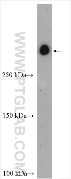 GPR179 Rabbit Polyclonal Antibody, Proteintech Unconjugated; 20 &mu;L:Antibodies,
