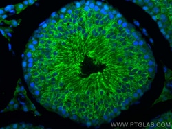 GPX4 Rabbit Polyclonal Antibody, Proteintech:Antibodies:Primary Antibodies