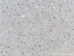 GRIA1 Rabbit Polyclonal Antibody, Proteintech:Antibodies:Primary Antibodies