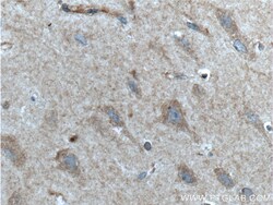 GRIA1 Rabbit Polyclonal Antibody, Proteintech:Antibodies:Primary Antibodies
