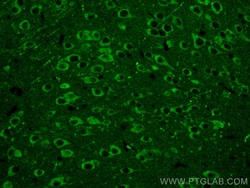 NMDAR1/GRIN1 Mouse Monoclonal Antibody, Proteintech Unconjugated; 150 &mu;L:Antibodies,