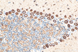 NMDAR1/GRIN1 Mouse Monoclonal Antibody, Proteintech Unconjugated; 150 &mu;L:Antibodies,