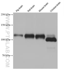 NMDAR1/GRIN1 Mouse Monoclonal Antibody, Proteintech Unconjugated; 150 &mu;L:Antibodies,