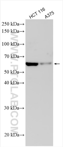 GSDMC Rabbit Polyclonal Antibody, Proteintech:Antistoffer:Primære antistoffer