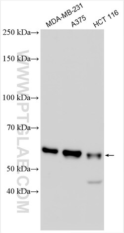 GSDMC Rabbit Polyclonal Antibody, Proteintech:Antistoffer:Primære antistoffer