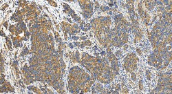 eRF3a/GSPT1 Rabbit Polyclonal Antibody, Proteintech Unconjugated; 20 &mu;L:Antibodies,