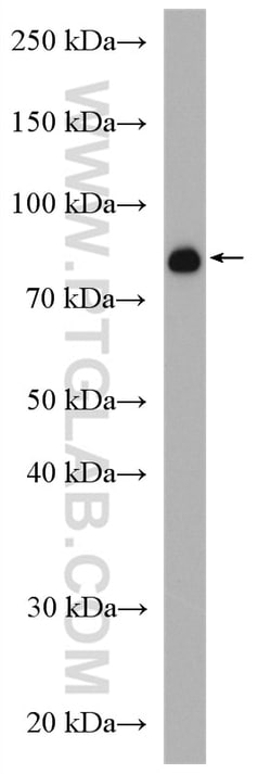 eRF3a/GSPT1 Rabbit Polyclonal Antibody, Proteintech Unconjugated; 20 &mu;L:Antibodies,