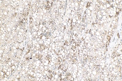 GSTK1 Rabbit Recombinant Antibody, Proteintech Unconjugated; 20 &mu;L:Antibodies,