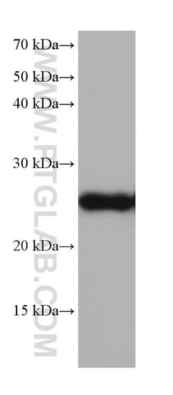 GSTM5 Mouse Monoclonal Antibody, Proteintech Unconjugated; 20 &mu;L:Antibodies,