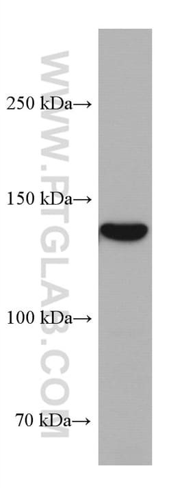 GUCY2C Mouse Monoclonal Antibody, Proteintech Unconjugated; 20 &mu;L:Antibodies,
