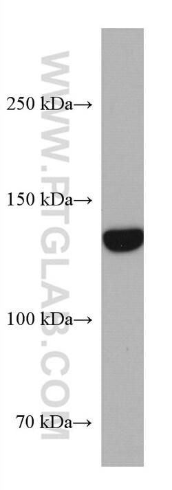 GUCY2C Mouse Monoclonal Antibody, Proteintech Unconjugated; 20 &mu;L:Antibodies,
