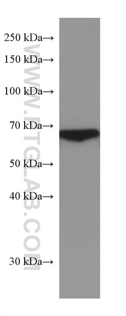 HABP2 Mouse Monoclonal Antibody, Proteintech Unconjugated; 20 &mu;L:Antibodies,