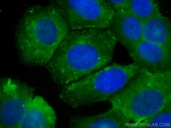HARS Mouse Monoclonal Antibody, Proteintech:Antibodies:Primary Antibodies